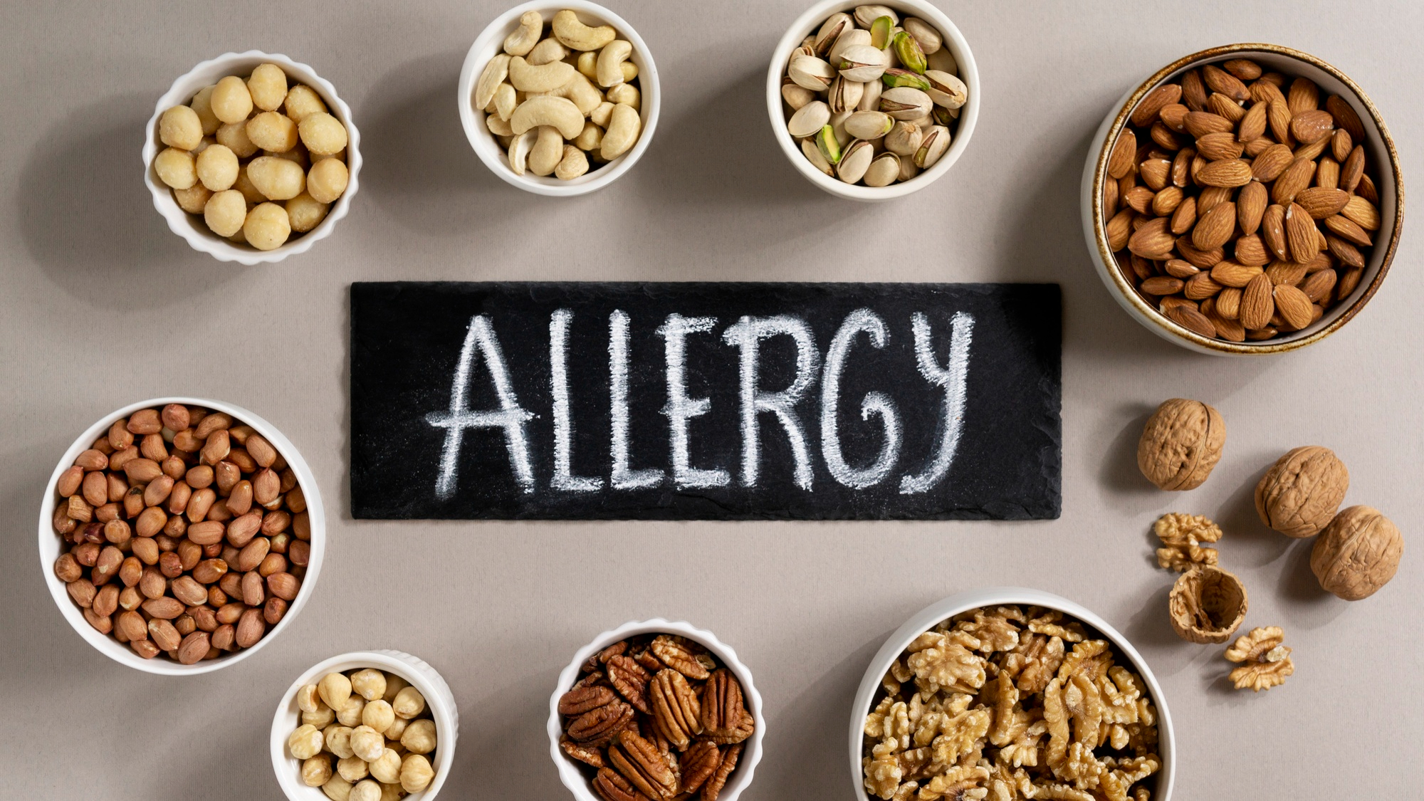 Nearly 1 in 20 children globally has food allergies and their signs are distinctly visible