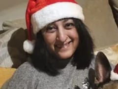 कुत्ते के चाटने से हुआ खतरनाक इंफेक्शन, सेप्सिस से महिला ने खोए चारों हाथ-पैर, जानें क्या है ये जानलेवा बीमारी