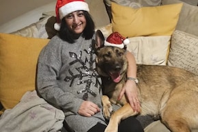 कुत्ते के चाटने से हुआ खतरनाक इंफेक्शन, सेप्सिस से महिला ने खोए चारों हाथ-पैर, जानें क्या है ये जानलेवा बीमारी