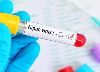 Kerala Nipah Patient Critical, 77 Contacts Under Observation; 2 In Highest-Risk Category