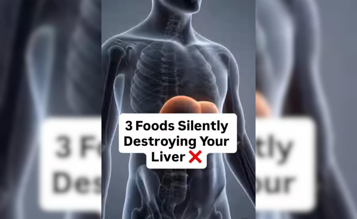 Liver Health: लिवर को साइलेंटली क‍िल कर रहे ये 3 फूड्स, डॉ. सौरभ सेठी ने बताया लिवर के लिए सबसे खराब चीजें कौन सी हैं