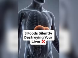 Liver Health: लिवर को साइलेंटली क&zwj;िल कर रहे ये 3 फूड्स, डॉ. सौरभ सेठी ने बताया लिवर के लिए सबसे खराब चीजें कौन सी हैं