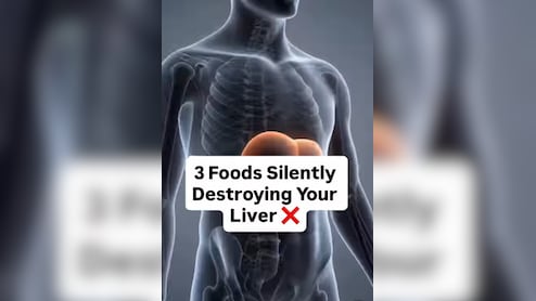 Liver Health: लिवर को साइलेंटली क&zwj;िल कर रहे ये 3 फूड्स, डॉ. सौरभ सेठी ने बताया लिवर के लिए सबसे खराब चीजें कौन सी हैं