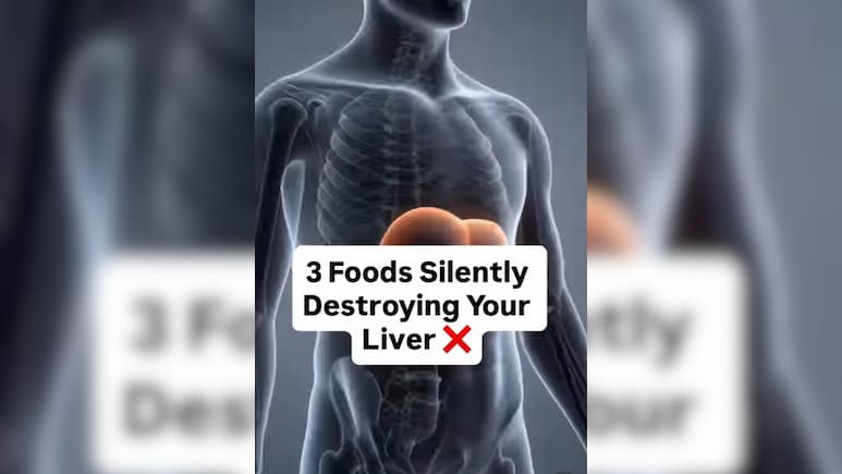 Liver Health: लिवर को साइलेंटली क&zwj;िल कर रहे ये 3 फूड्स, डॉ. सौरभ सेठी ने बताया लिवर के लिए सबसे खराब चीजें कौन सी हैं