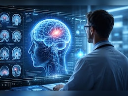 वैज्ञानिकों ने बनाया नया AI मॉडल, पलभर में पकड़ लेगा दिमाग की बीमारी, ब्रेन MRI पढ़ने में 97.5% एक्यूरेसी