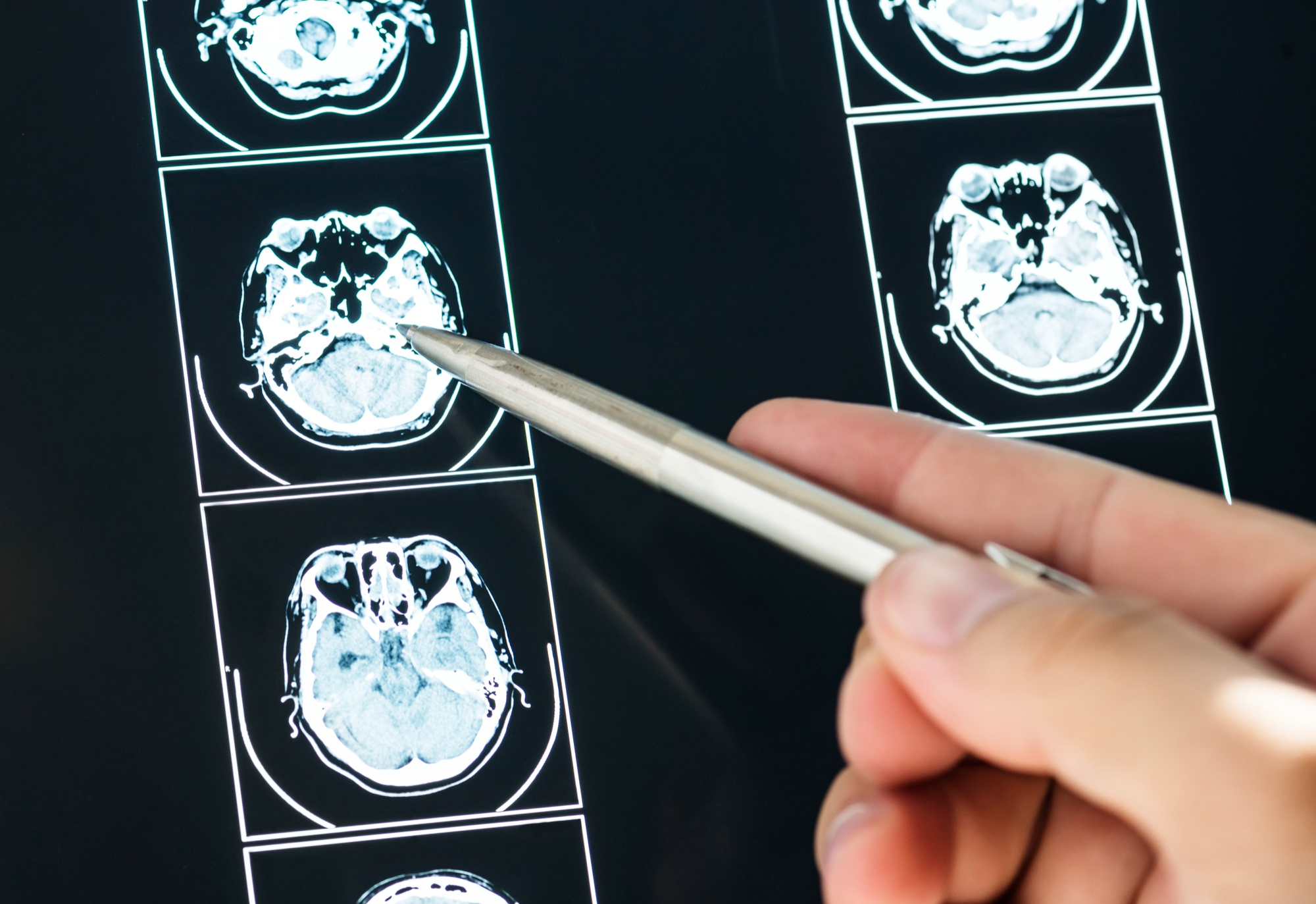 Cognitive slowdowns should not be underestimated