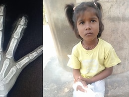 खौफनाक! स्कूल मे मिड डे मील के दौरान कटीं 6 साल की बच्ची की उंगलियां, स्कूल स्टाफ ने उठाकर फेंका