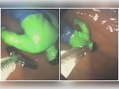 बच्चे ने निगला HULK! ऑपरेशन करने वाले डॉक्टर भी हैरान, देखिए