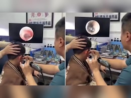 VIDEO: बच्चे के कान में था दर्द, मशीन से चेक किया...तो चौंक उठे डॉक्टर