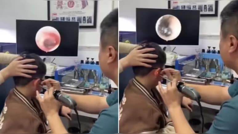 VIDEO: बच्चे के कान में था दर्द, मशीन से चेक किया...तो चौंक उठे डॉक्टर