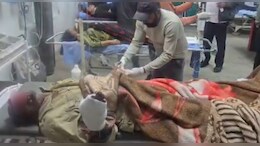 हनुमानगढ़ में जंगली जानवर ने क&zwj;िसान पर क&zwj;िया हमला, नाक और दोनों हाथ में गहरा घाव&nbsp;