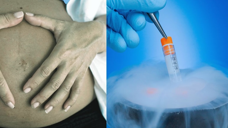 Badlapur Egg Donation : Egg डोनेशन महिलांसाठी किती धोकादायक? बदलापुरातील भयंकर प्रकरणानंतर नवा मुद्दा चर्चेत