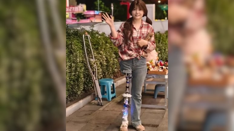 कैंसर का पता चला तो पिता ने छोड़ा साथ...पैर कटा तो मां ने भी खत्म कर लिया रिश्ता, इमोशनल कर देगी स्टोरी