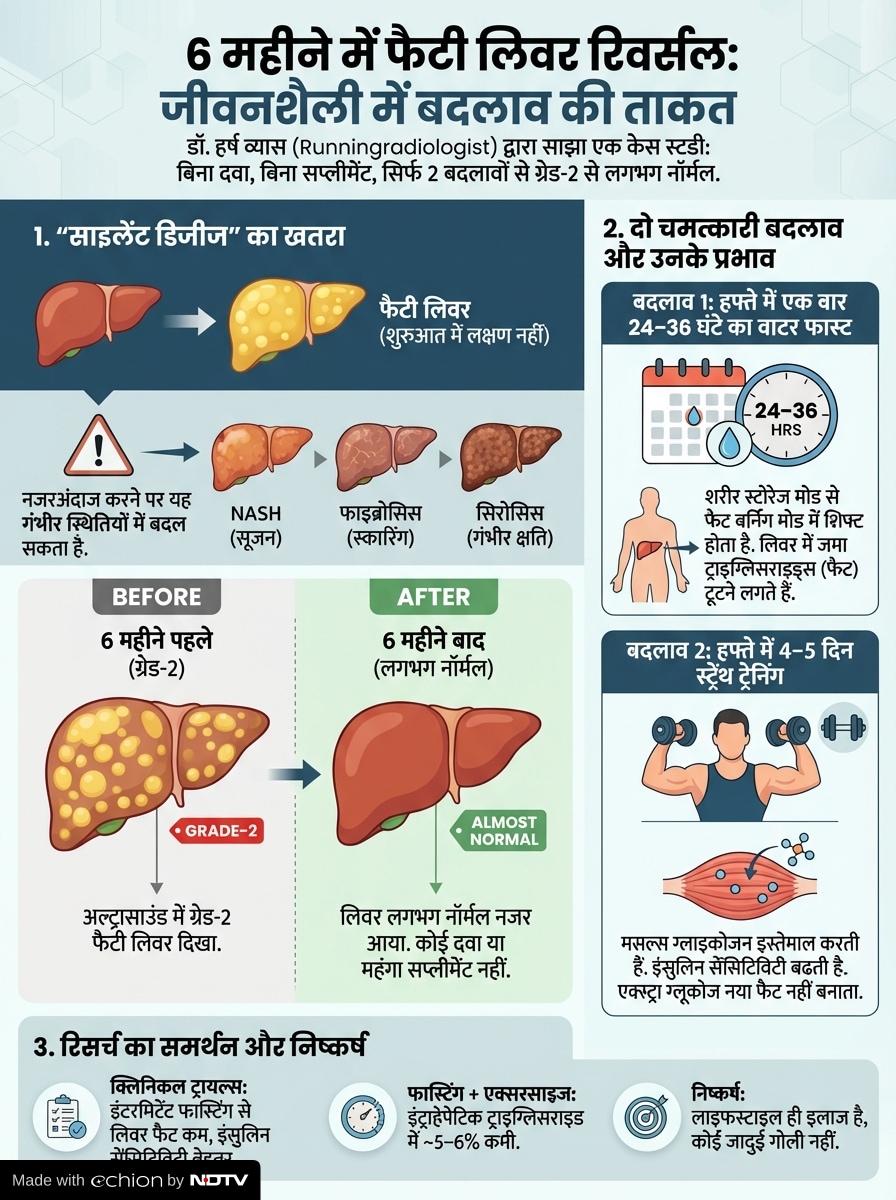 Add image caption here