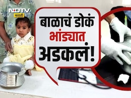 Jalgaon News: चिमुकलीचं डोकं भांड्यात आणि डॉक्टरांच्या हातात कटर;पाहा श्वास रोखून धरायला लावणारा Viral Video