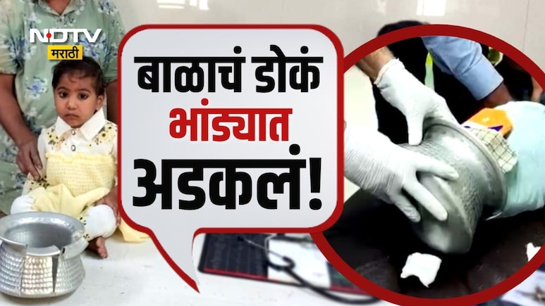 Jalgaon News: चिमुकलीचं डोकं भांड्यात आणि डॉक्टरांच्या हातात कटर;पाहा श्वास रोखून धरायला लावणारा Viral Video