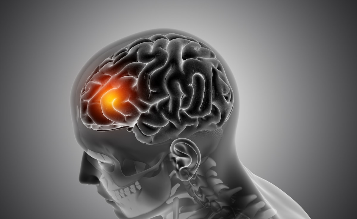 Two Agniveer Trainees Die of Suspected Meningococcal Infection in Shillong Training Centre