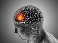 Shillong Agniveer Deaths Trigger High Alert Over Fast-Moving Meningitis Threat