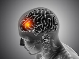 Shillong Agniveer Deaths Trigger High Alert Over Fast-Moving Meningitis Threat