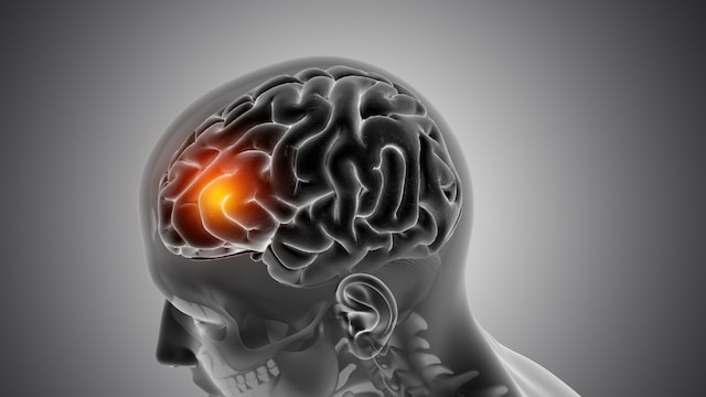 Image used for representative purpose only