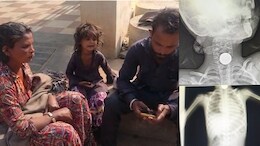 Guna District Hospital: गरीब मासूम के गले में फंसा 5 का सिक्का, &nbsp;जिला अस्पताल ने भगाया, &nbsp;बोले-हमारे पास मशीन और डॉक्टर नहीं है !