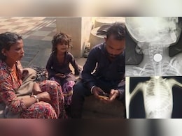 Guna District Hospital: गरीब मासूम के गले में फंसा 5 का सिक्का, &nbsp;जिला अस्पताल ने भगाया, &nbsp;बोले-हमारे पास मशीन और डॉक्टर नहीं है !