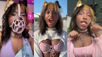 मैं इंसान नहीं,पोमेरेनियन हूं..20साल की लड़की ने क्यों लगवा लिए नकली दांत, पूंछ..कुत्ता बनने का ऐसा क्या जुनून