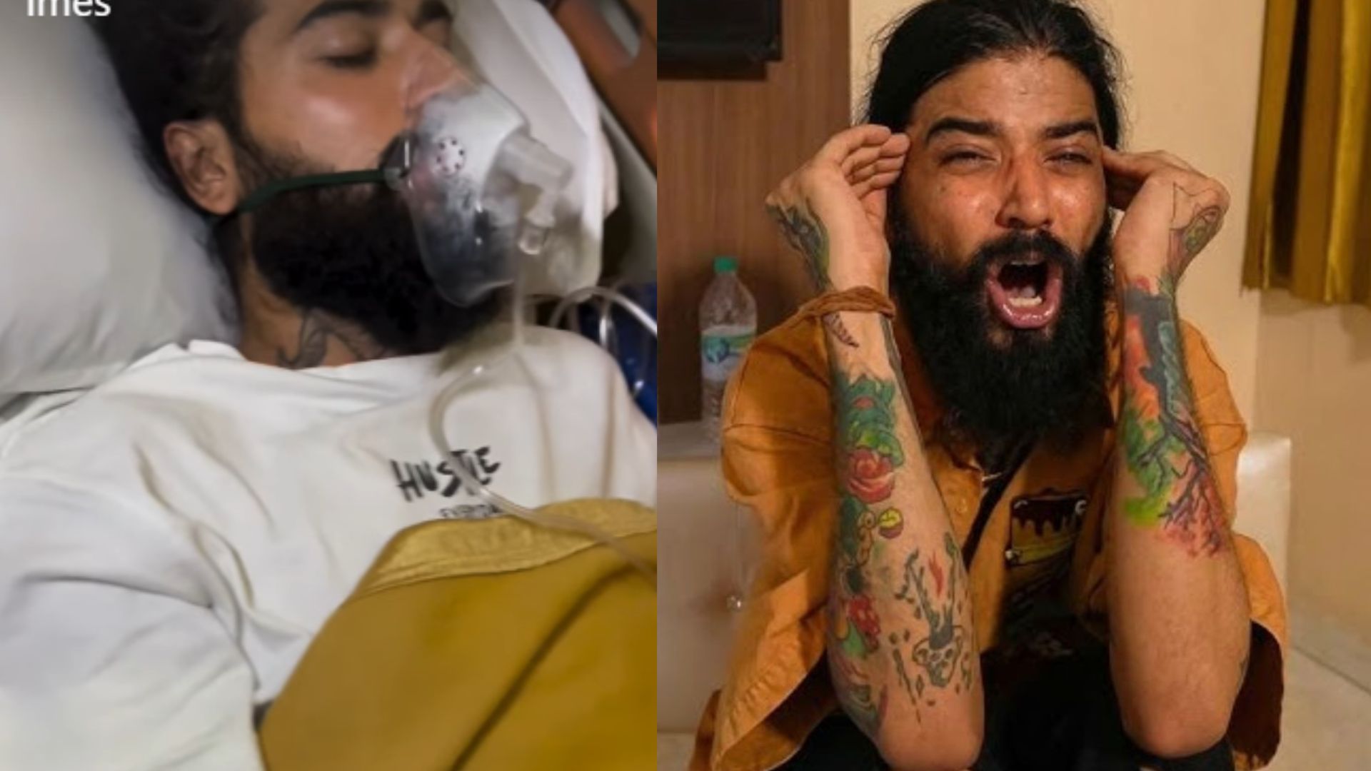 Anurag Dobhal Is "Fighting Hard For His Life" After Being Moved Out Of ICU, Says Manager