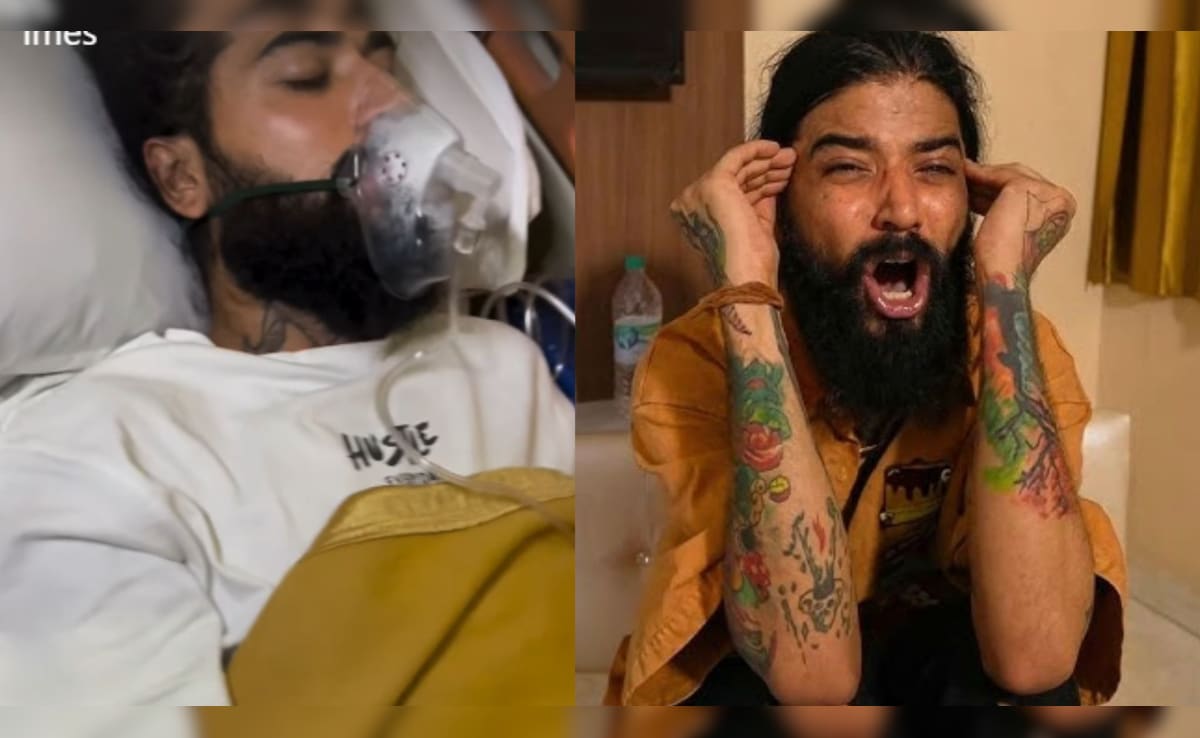 Anurag Dobhal Is "Fighting Hard For His Life" After Being Moved Out Of ICU, Says Manager