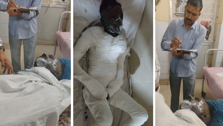 सवाई माधोपुर: पेट्रोल डालकर युवक को जिंदा जलाया, जयपुर ले जाते बीच रास्ते में तोड़ा दम