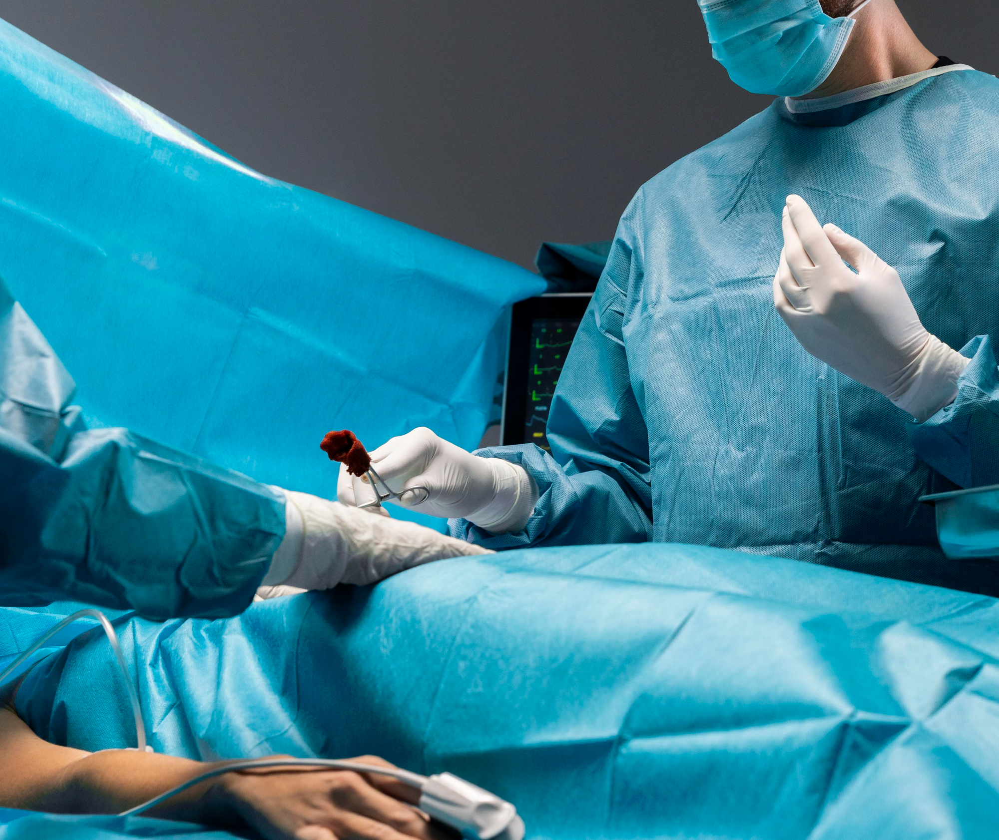 India's Organ Crisis Deepens As 82,000 Patients Wait For Transplants