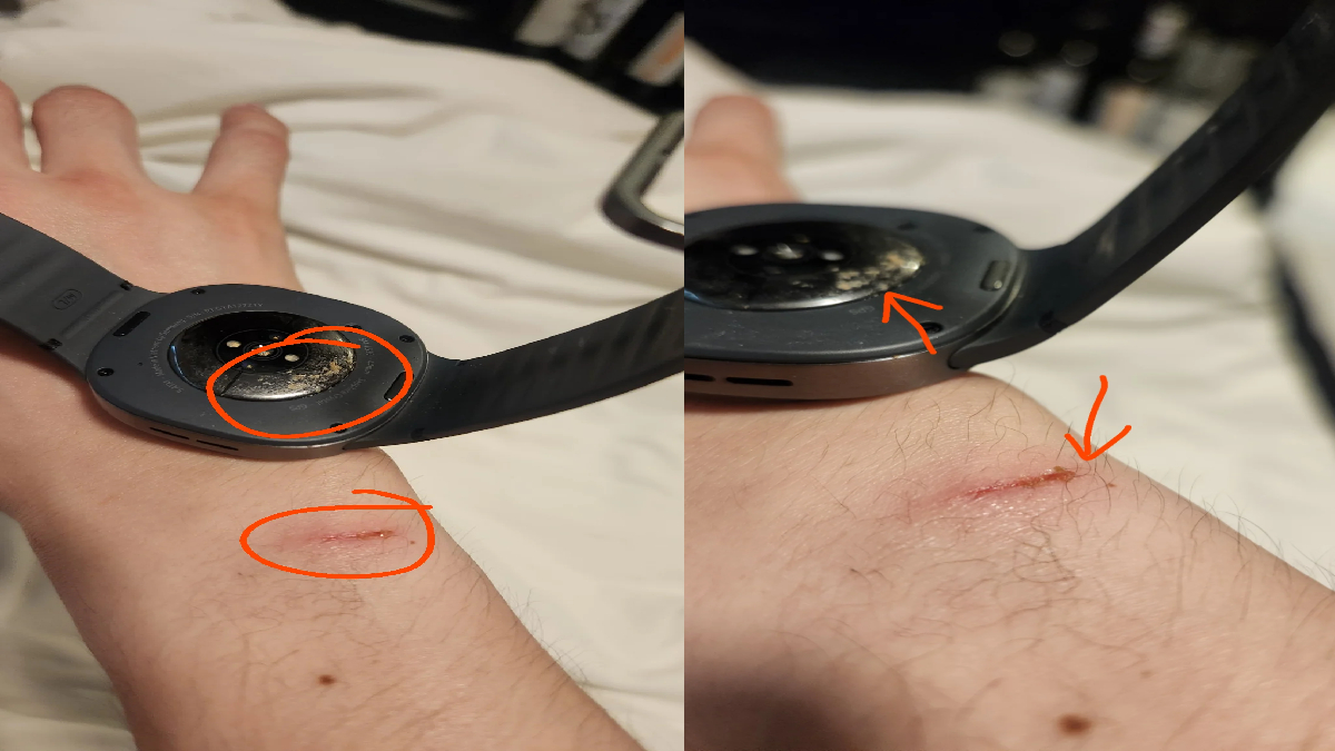 Galaxy Watch 8 पहन कर सोया, जल गई कलाई! Samsung ने दिया हैरानी वाला जवाब ...