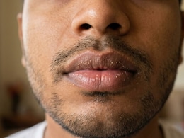 Noticed Tiny White Spots On Your Lips? Here's What They Are And Whether You Should Worry
