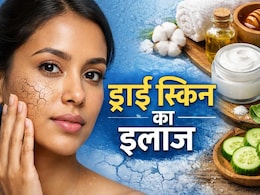 स्किन बहुत ज्यादा ड्राई हो जाए तो क्या करें? बस अपनाएं ये 5 आसान तरीके और पाएं मुलायम और चमकती त्वचा