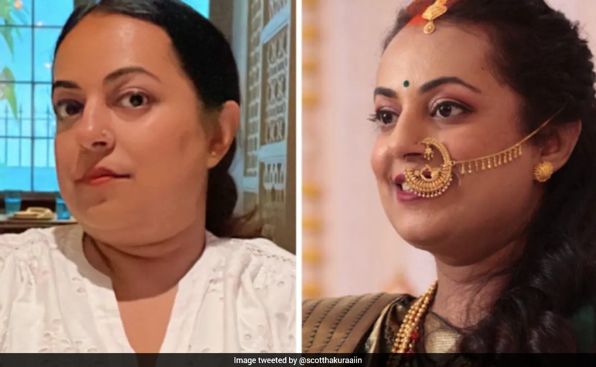 Indian Woman Shares Reality Of Losing 30 Kg With Ozempic: "Your Stomach Refuses To Cooperate"