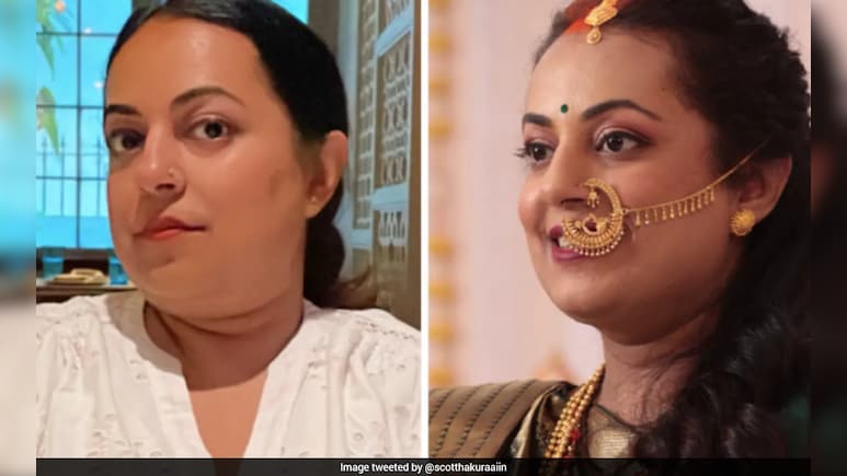 दवा से 30 किलो वजन घटाया&hellip; लेकिन चुकानी पड़ी भारी कीमत! महिला ने बताई Ozempic की कड़वी सच्चाई