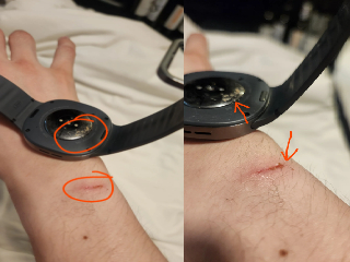 Galaxy Watch 8 पहन कर सोया, जल गई कलाई! Samsung ने दिया हैरानी वाला जवाब ...