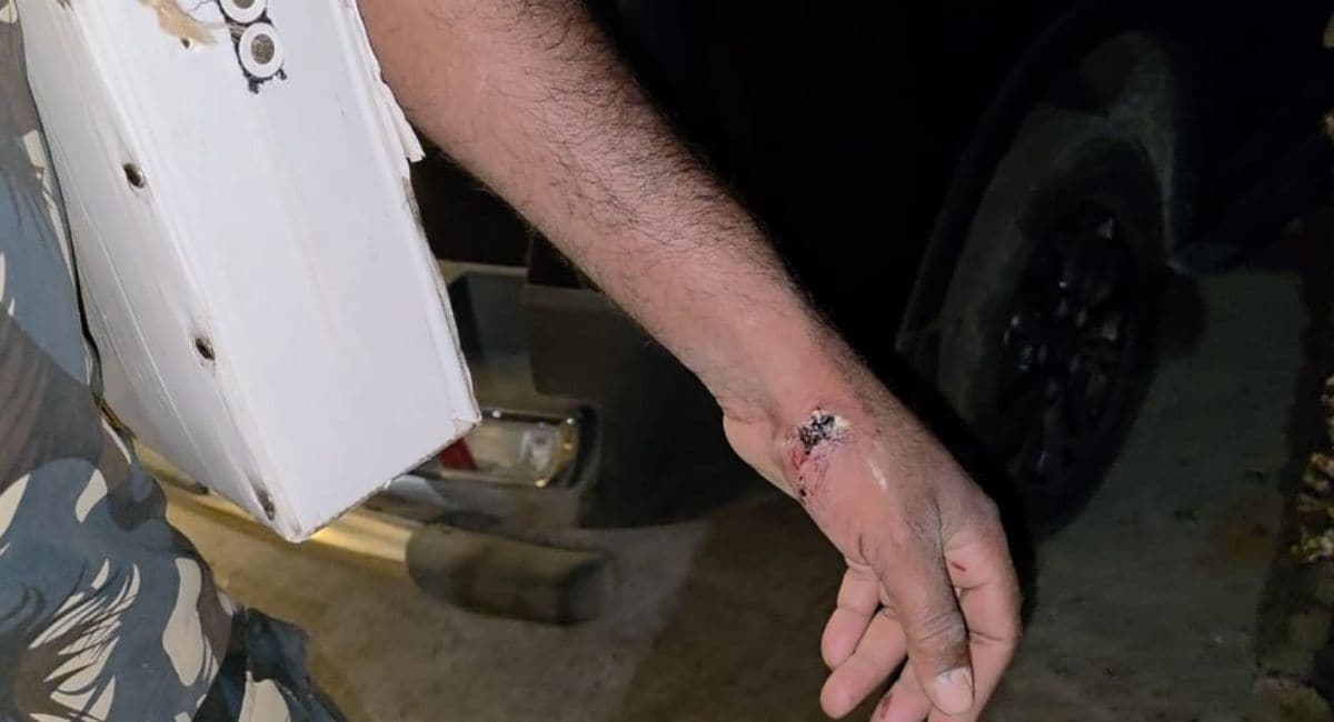 पथराव के दौरान जवान घायल हो गया था. 