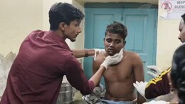 अब सिरोही में भी पैंथर का अटैक, युवक गंभीर रूप से घायल... ग्रामीणों में फैली दहशत