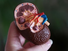 किडनी ठीक रखने के लिए क्या खाना चाहिए? जानें डॉक्टर की सुझाई हुई डाइट 