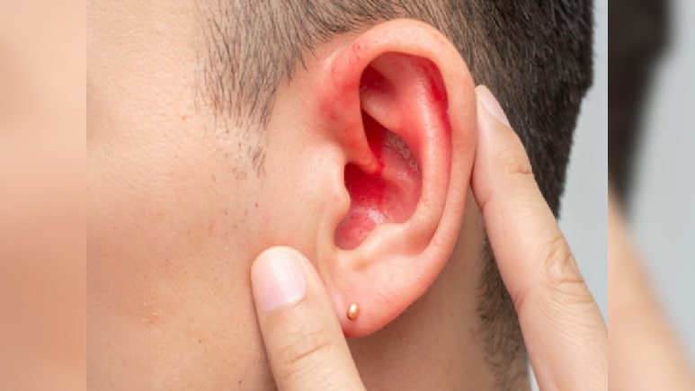 कान से पानी आने की समस्या को न लें हल्के में, जानिए इलाज और बचाव