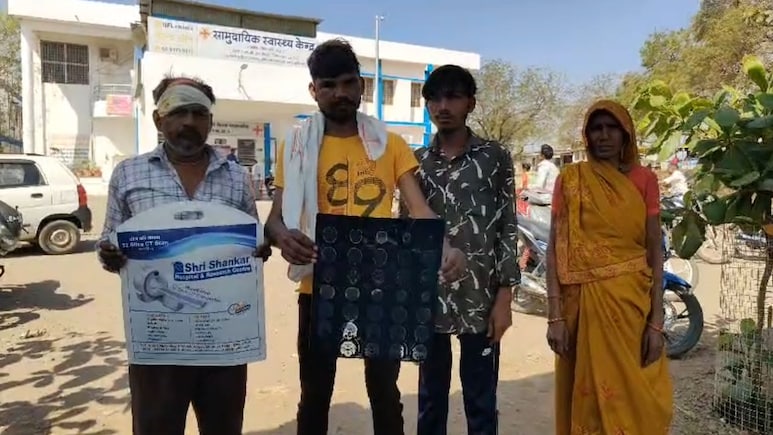 Dhar News: धामनोद में पिता-बेटे और भतीजे पर लाठी-डंडों से हमला, तीन घायल, आरोपियों ने जान से मारने की दी धमकी