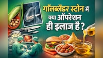 गॉल ब्लैडर में पथरी है? क्या Gallbladder निकालना ही एक मात्र रास्ता है... यहां हैं दूसरे ऑप्शन
