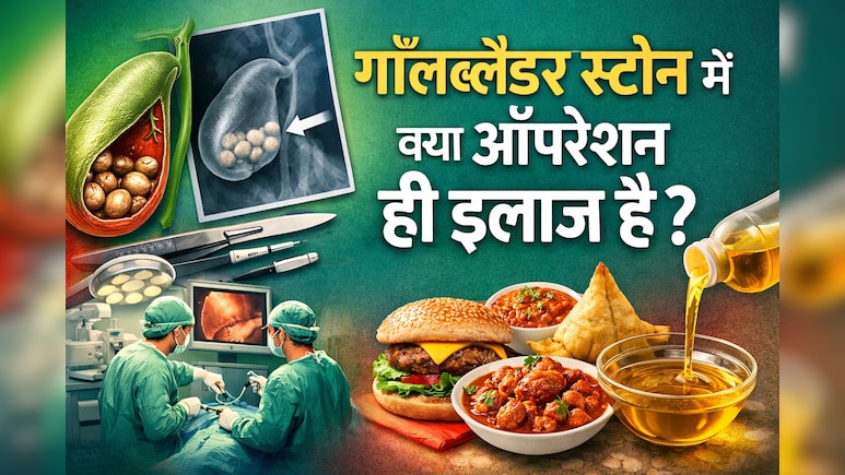 गॉल ब्लैडर में पथरी है? क्या Gallbladder निकालना ही एक मात्र रास्ता है... यहां हैं दूसरे ऑप्शन