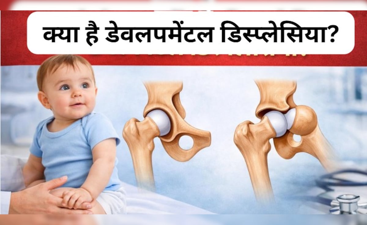 जब चलना-फिरना तक हो जाता है मुश्किल...क्या है डेवलपमेंटल डिस्प्लेसिया? जानिए इस बीमारी के लक्षण और  कारण