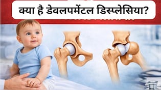 जब चलना-फिरना तक हो जाता है मुश्किल...क्या है डेवलपमेंटल डिस्प्लेसिया? जानिए इस बीमारी के लक्षण और  कारण