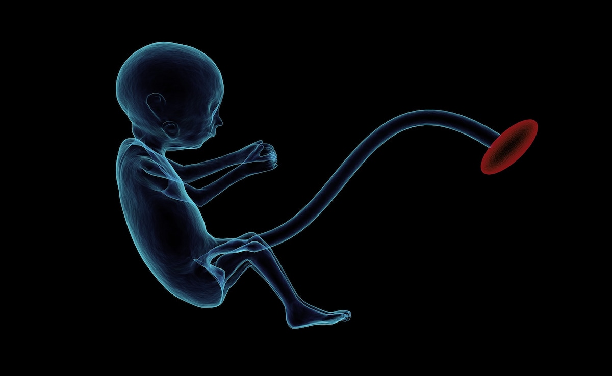 अब इलाज में काम आ रहा है बच्चे का गर्भनाल या प्लेसेंटा, घाव भरने से लेकर आंखों के इलाज तक कर रहा मदद