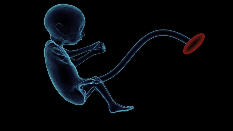 अब इलाज में काम आ रहा है बच्चे का गर्भनाल या प्लेसेंटा, घाव भरने से लेकर आंखों के इलाज तक कर रहा मदद