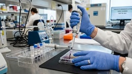 US Scientists Develop Simple 4-Marker Blood Test To Detect Pancreatic Cancer Early