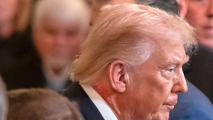 Skin Cream Caused Trump's Neck Redness, Says White House: What It Means